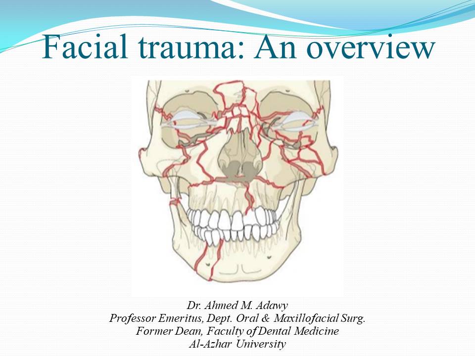 Facial trauma  an overview